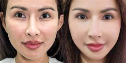 ảnh chụp màn hình căng bóng da mặt