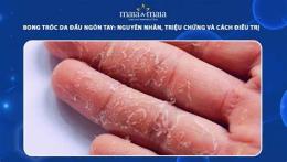 ảnh chụp màn hình da tay bong tróc