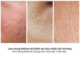 ảnh chụp màn hình dùng retinol bị bong da