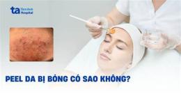 ảnh chụp màn hình hình ảnh peel da bị bỏng
