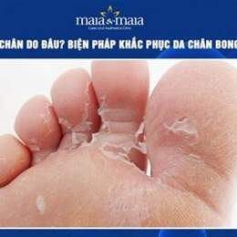 bong da chân là thiếu chất gì