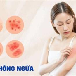 da nổi bông