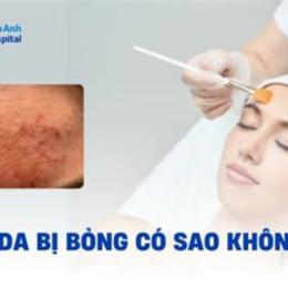 dấu hiệu peel da bị bỏng