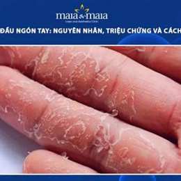 đầu ngón tay bị bong tróc da là bệnh gì