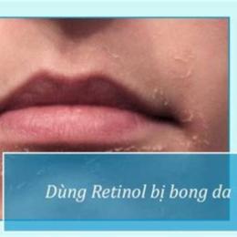 dùng retinol bị bong da
