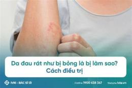 giao diện app da đau rát như bị bỏng
