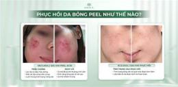 giao diện app dấu hiệu peel da bị bỏng