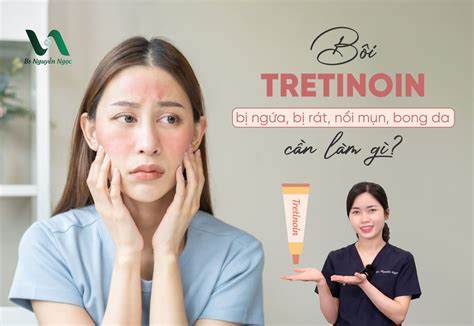 giao diện app dùng tretinoin bị bong da nên làm gì
