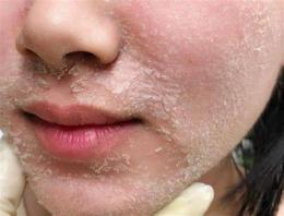 giao diện app sản phẩm peel da bong tróc