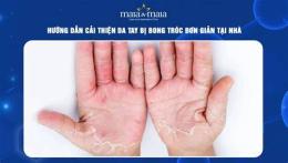 giao diện app tại sao da tay bị bong tróc