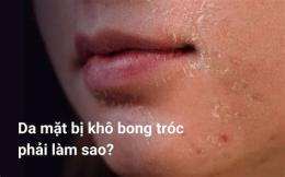 hướng dẫn sử dụng bong tróc da