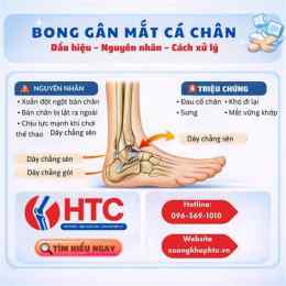 hướng dẫn sử dụng chân bị bong da