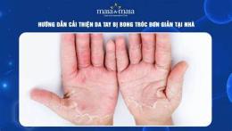 hướng dẫn sử dụng da bị bong tróc ở tay chân