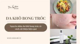 hướng dẫn sử dụng da khô bong tróc bôi gì