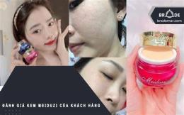 hướng dẫn sử dụng kem meiduzi có bong da không