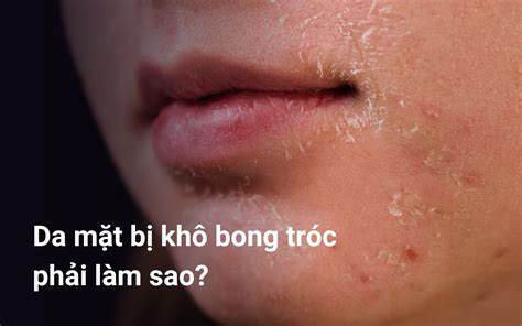 hướng dẫn sử dụng làm sao để da nhanh bong tróc