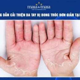 tại sao da tay bị bong tróc