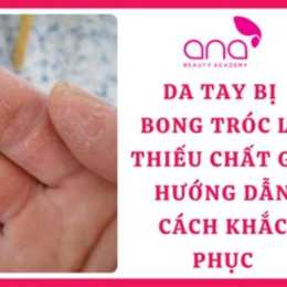 tay bị bong da là thiếu chất gì