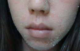 tính năng nổi bật da mặt bị bong tróc vảy trắng