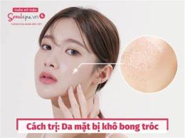 tính năng nổi bật da mặt khô bong tróc nên dùng gì