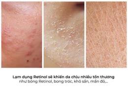 tính năng nổi bật dùng retinol bị bong da