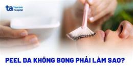 tính năng nổi bật peel da không bong phải làm sao